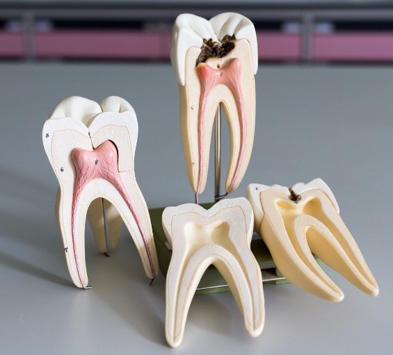 Models of teeth on table