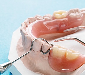 partial denture sitting on a plaster mold of a mouth