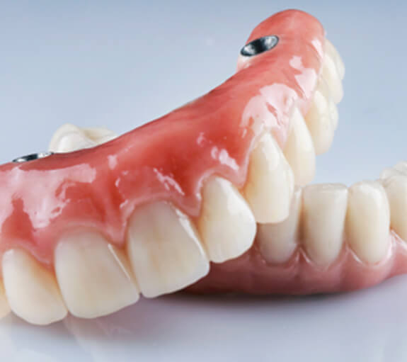 A closeup of two implant dentures